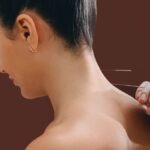L’agopuntura della cervicale: tra dolore e benessere