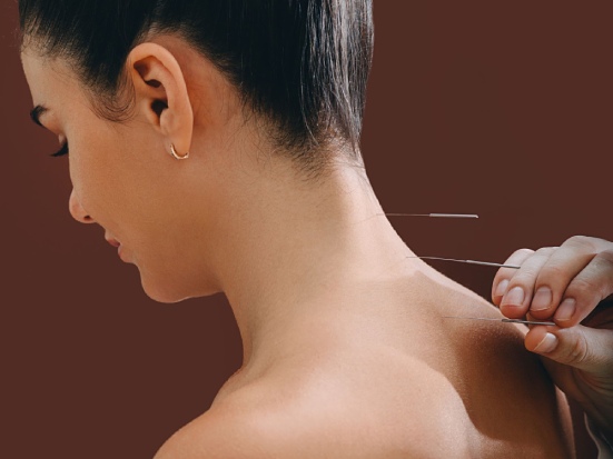 L’agopuntura della cervicale: tra dolore e benessere