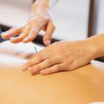 Agopuntura e disturbi digestivi: tecniche e benefici