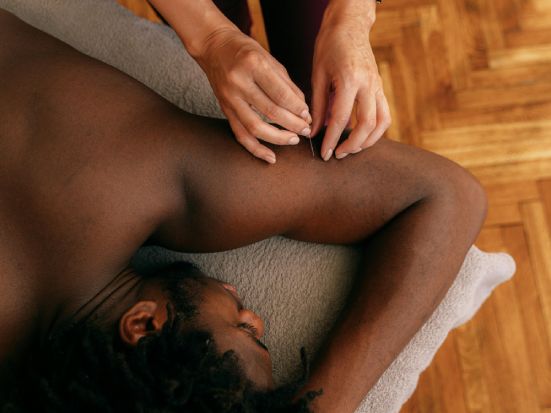 Agopuntura e rilassamento