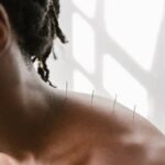 Agopuntura per la cervicale: quando considerarla come trattamento